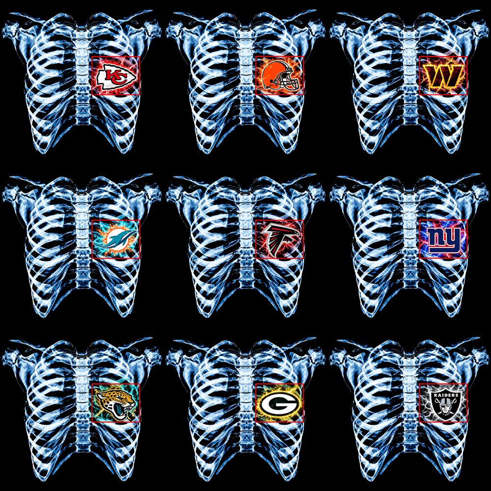 32 X-ray Scan Football Teams In My Heart Designs Bundle PNG